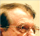 ویکسین لگوانے والوں میں کروناوائرس شکلیںتبدیل کرتار ہے گا