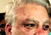 محسن بیگ جسمانی ریمانڈ پر پولیس کے حوالے