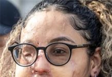 پاکستانی میڈیکل کی طالبہ نافیہ اکرام پر تیزاب پھینکنے والا ملزم 5سال بعد گرفتار