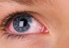 آنکھوں کا لال ہونا بھی کورونا کی علامت ہے