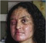 نافیہ پر تیزاب منصوبہ بندی کے تحت پھینکا گیا:والدکی دہائی