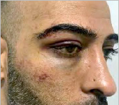 پاکستانی نژادنوجوان نوید اعظم پولیس گردی کا شکار ، چہرے پر گہرے زخم