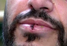 بروکلین میں نامعلوم افراد کا یمنی دکاندار پر حملہ، شدیدزخمی