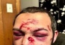 فجر کی نماز کیلئے مسجد جانیوالے مسلم شہری پر نامعلوم افراد کا مبینہ تشدد