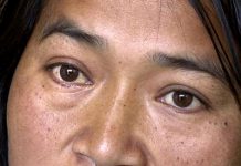 منی پور فسادات ، بھارت میں آج بھی لوگ کیمپوں میں ابتر زندگی گزارنے پر مجبور